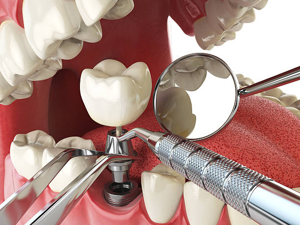 Best Emergency Dental Care for Broken or Chipped Teeth in Vails Gate, NY