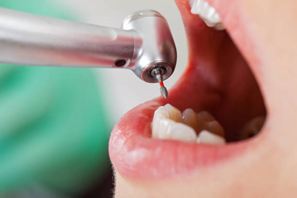 Best Emergency Tooth Extraction in Vails Gate, NY
